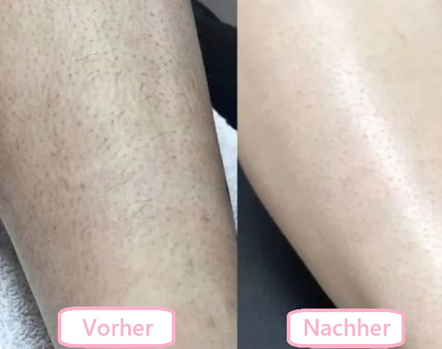 SilkShave™ - 5-in-1 Damen Körperrasierer