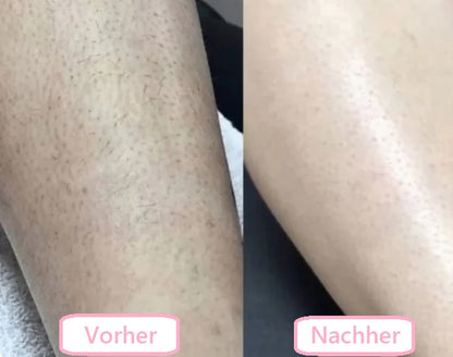 SilkShave™ - 5-in-1 Damen Körperrasierer