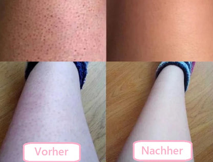 SilkShave™ - 5-in-1 Damen Körperrasierer